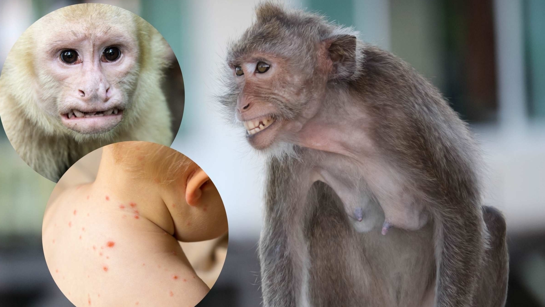 Вчені: мавпа віспа передається тільки при сексі між чоловіками, а не при дотику