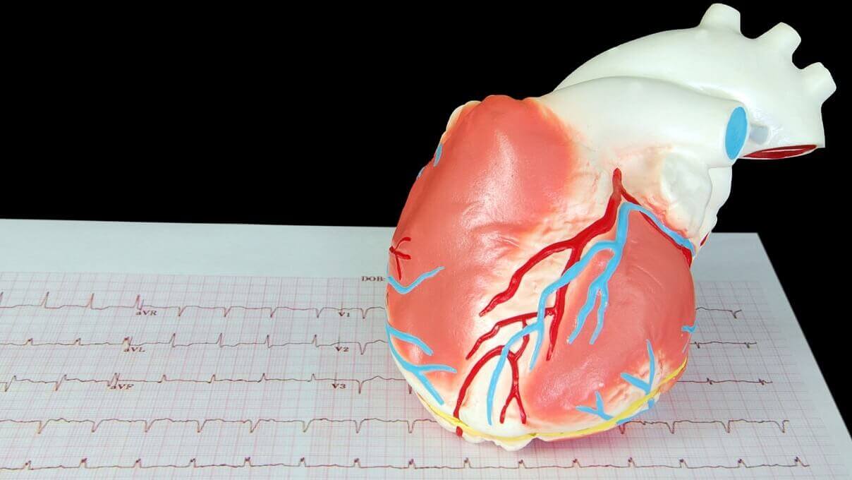 Медицинские перевозки пациентов с инфарктом и ключевые особенности организации