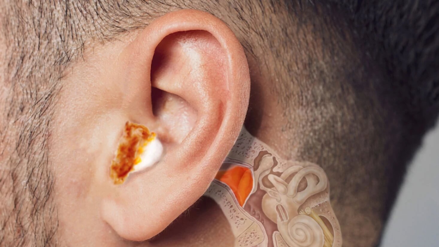 Подорож у cвіт cереднього вуха: від слухових кісточок до боротьби з отитом