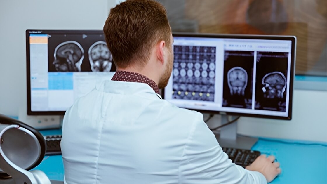 МРТ мозку для лікування дипресії: дослідження вчених